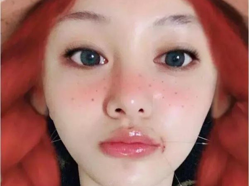 郑爽嘴角的疤是怎么回事