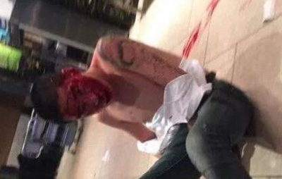 IR刘一手被打的头破血流图片是真的吗 刘一手被谁打了