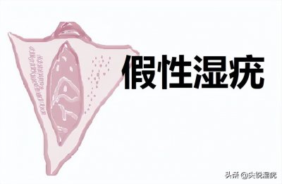 真假尖锐疣体图文鉴别