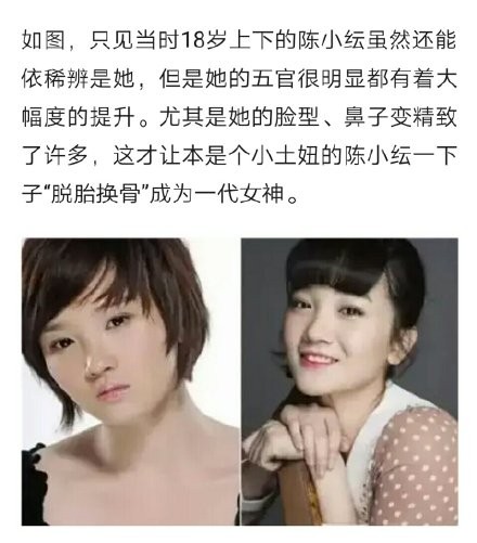 陈小纭公开承认曾“整容”十几次,旧照曝光后,网友:差距太大了
