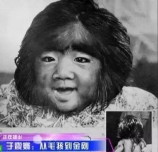 中国毛孩:8岁演电影爆红,成年绝望到自杀,恋情受阻仍不放弃