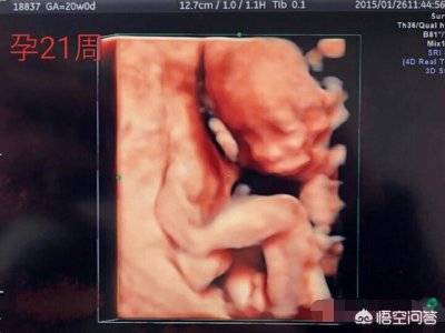 ​怀孕21周的胎儿图是什么样的(21周B超)