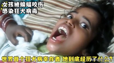 世界首个狂犬病发作,却意外存活下来的人,她到底经历了什么?