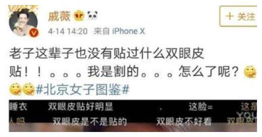 戚薇正面回答网友问题,贴双眼皮了吧?戚薇:老子是割的怎么了