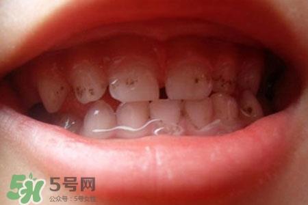 刷牙后吃东西发苦正常吗?为什么刷牙后吃东西发苦? 刷牙后吃东西发苦正常吗?为什么刷牙后吃东西发苦?